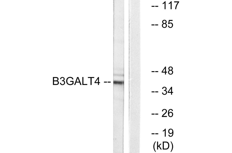 Western Blot - Anti-B3GALT4 Antibody (C14714) - Antibodies.com