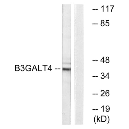 Western Blot - Anti-B3GALT4 Antibody (C14714) - Antibodies.com