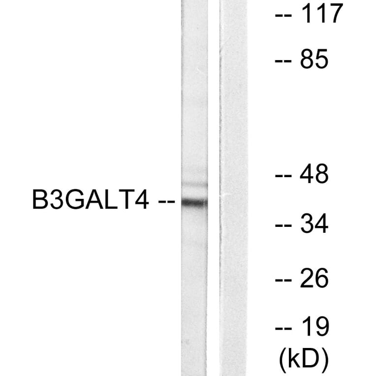 Western Blot - Anti-B3GALT4 Antibody (C14714) - Antibodies.com