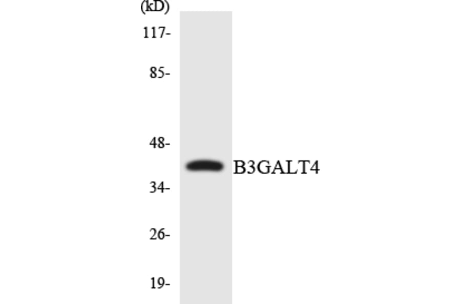 Western Blot - Anti-B3GALT4 Antibody (R12-2530) - Antibodies.com