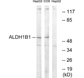 Western Blot - Anti-ALDH1B1 Antibody (C14388) - Antibodies.com