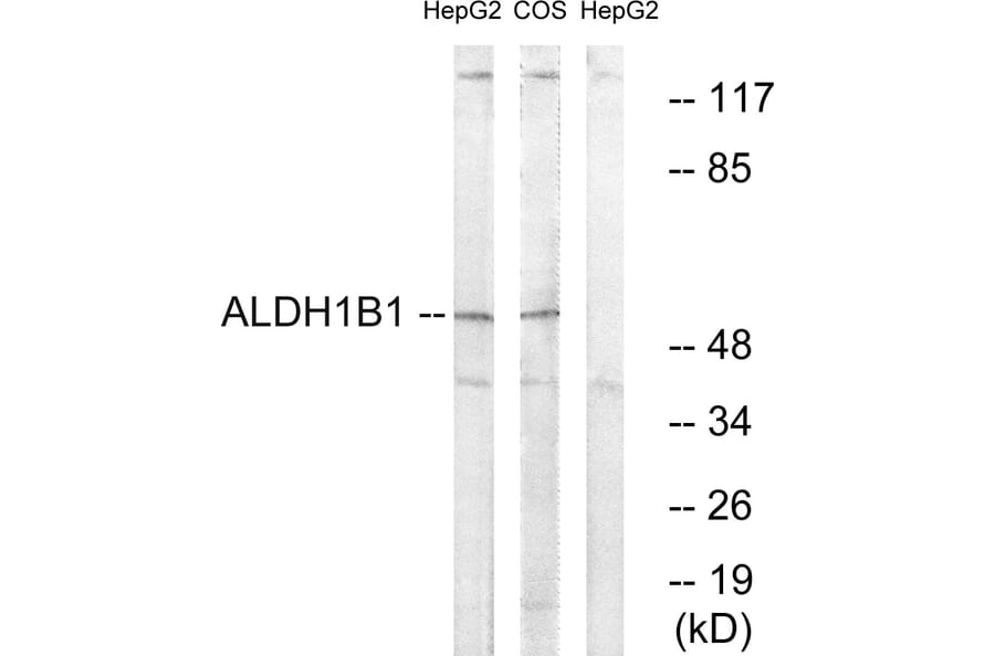Western Blot - Anti-ALDH1B1 Antibody (C14388) - Antibodies.com