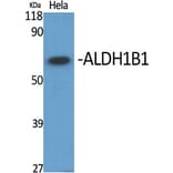 Western Blot - Anti-ALDH1B1 Antibody (C14388) - Antibodies.com