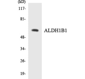 Western Blot - Anti-ALDH1B1 Antibody (R12-2474) - Antibodies.com
