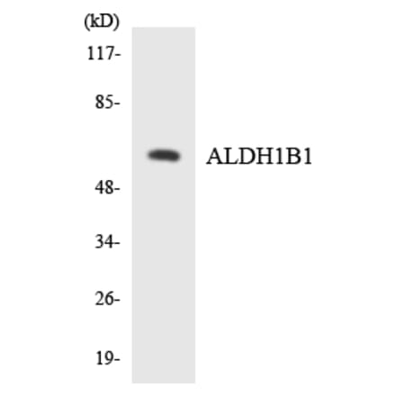 Western Blot - Anti-ALDH1B1 Antibody (R12-2474) - Antibodies.com