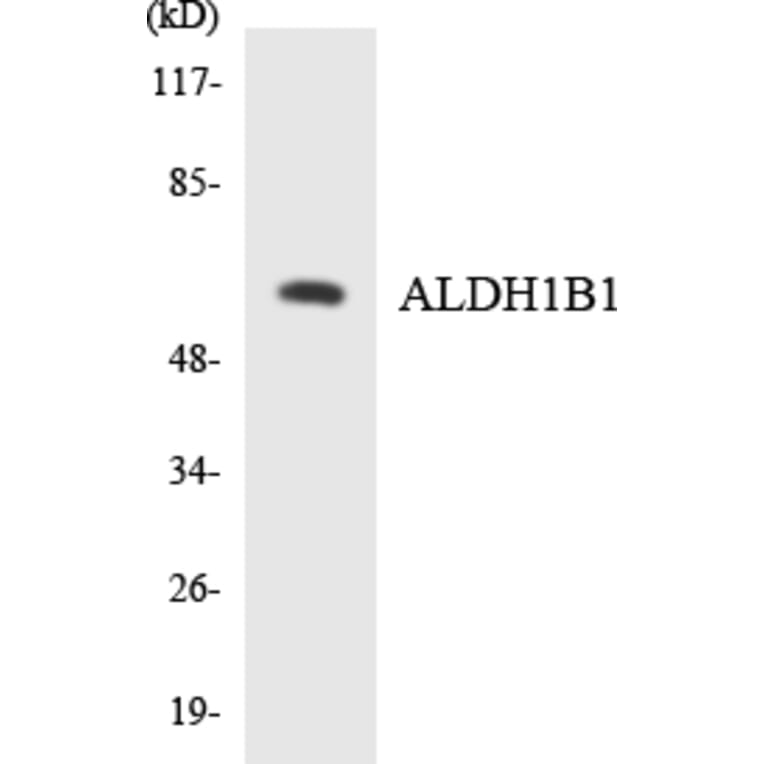 Western Blot - Anti-ALDH1B1 Antibody (R12-2474) - Antibodies.com