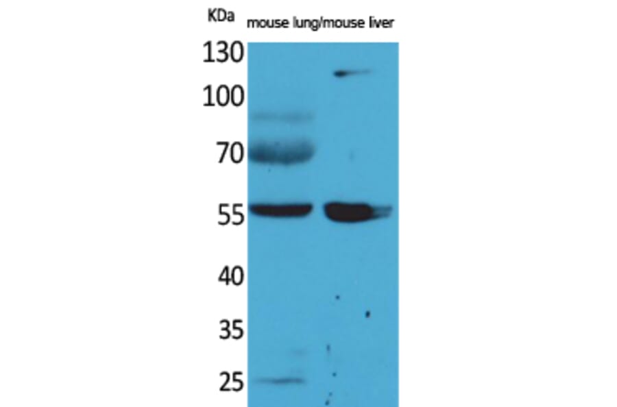 Western Blot - Anti-ALDH1A1 Antibody (C30034) - Antibodies.com