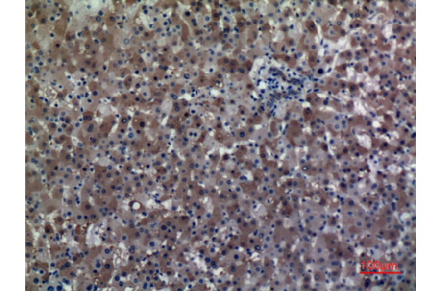 Immunohistochemistry - Anti-ALDH1A1 Antibody (C30034) - Antibodies.com