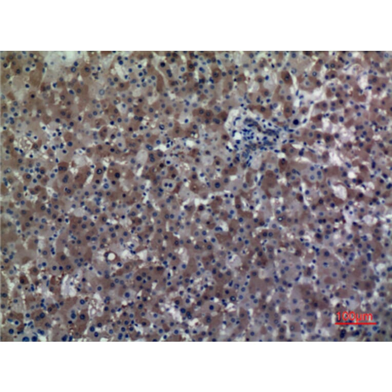 Immunohistochemistry - Anti-ALDH1A1 Antibody (C30034) - Antibodies.com