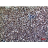 Immunohistochemistry - Anti-ALDH1A1 Antibody (C30034) - Antibodies.com