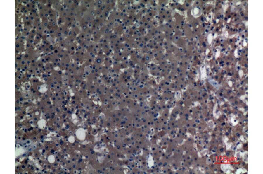 Immunohistochemistry - Anti-ALDH1A1 Antibody (C30034) - Antibodies.com