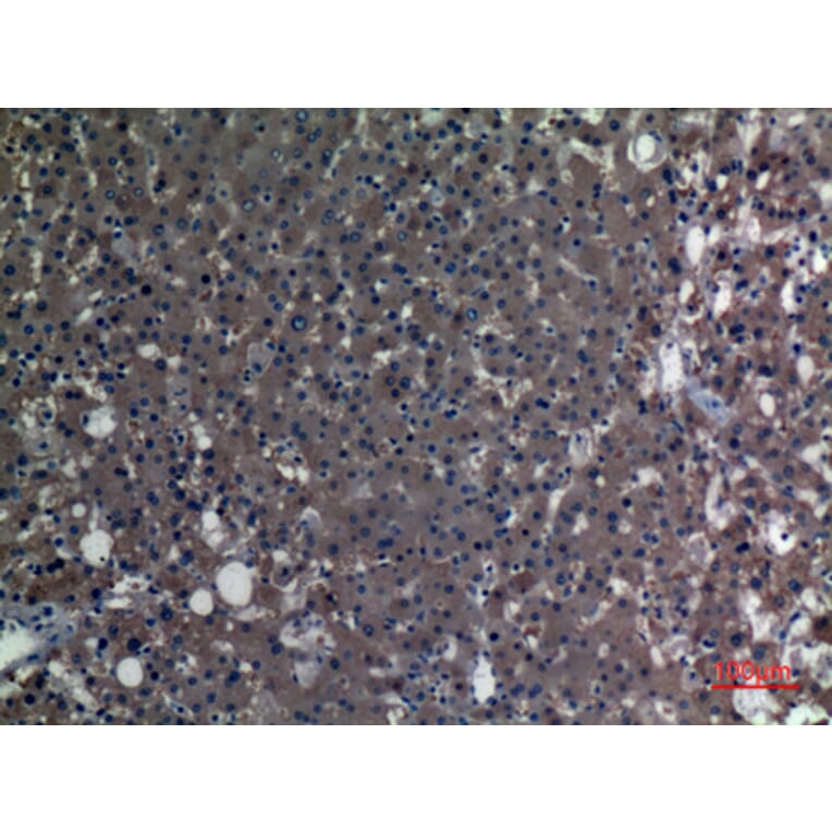 Immunohistochemistry - Anti-ALDH1A1 Antibody (C30034) - Antibodies.com