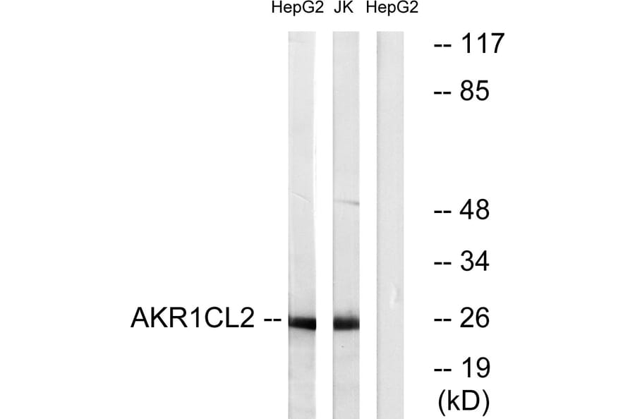 Western Blot - Anti-AKR1CL2 Antibody (C14398) - Antibodies.com