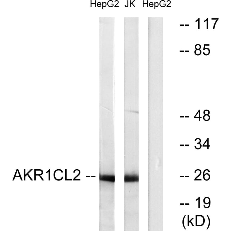 Western Blot - Anti-AKR1CL2 Antibody (C14398) - Antibodies.com