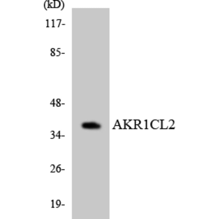 Western Blot - Anti-AKR1CL2 Antibody (R12-2472) - Antibodies.com