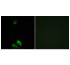 Immunofluorescence - Anti-AKR1CL1 Antibody (C14397) - Antibodies.com