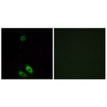 Immunofluorescence - Anti-AKR1CL1 Antibody (C14397) - Antibodies.com