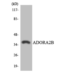Western Blot - Anti-ADORA2B Antibody (R12-2454) - Antibodies.com
