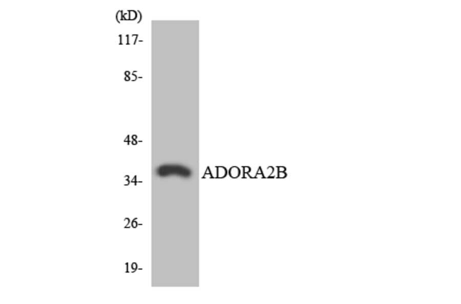 Western Blot - Anti-ADORA2B Antibody (R12-2454) - Antibodies.com