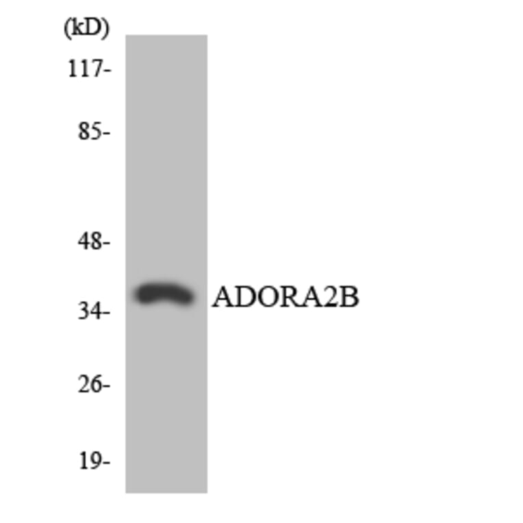 Western Blot - Anti-ADORA2B Antibody (R12-2454) - Antibodies.com
