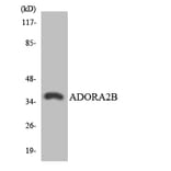 Western Blot - Anti-ADORA2B Antibody (R12-2454) - Antibodies.com