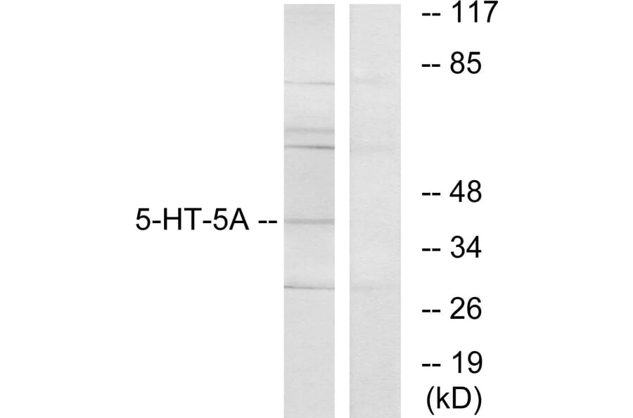 Western Blot - Anti-5-HT-5A Antibody (C12018) - Antibodies.com