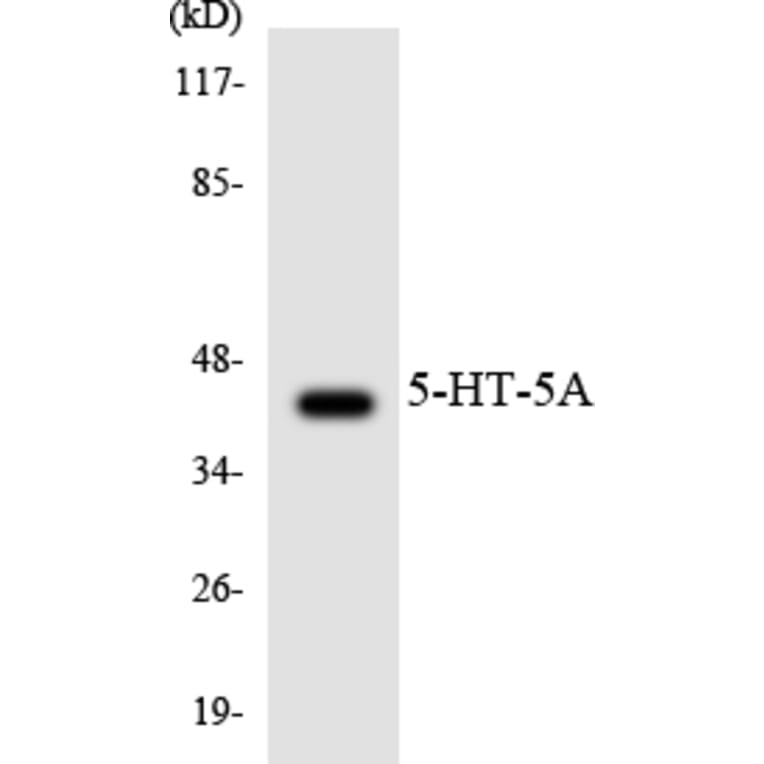 Western Blot - Anti-5-HT-5A Antibody (R12-2421) - Antibodies.com