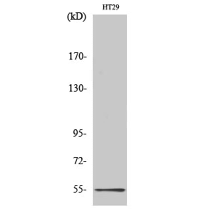 Western Blot - Anti-5-HT-3A Antibody (C12016) - Antibodies.com