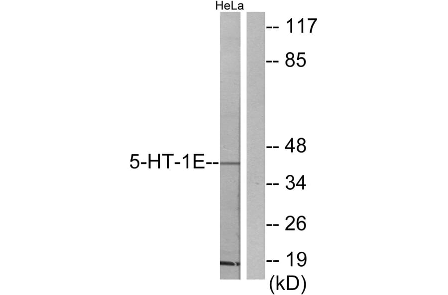 Western Blot - Anti-5-HT-1E Antibody (C12011) - Antibodies.com