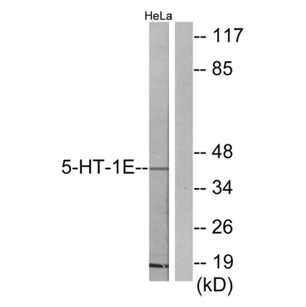 Western Blot - Anti-5-HT-1E Antibody (C12011) - Antibodies.com