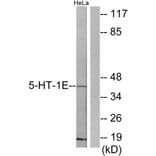 Western Blot - Anti-5-HT-1E Antibody (C12011) - Antibodies.com