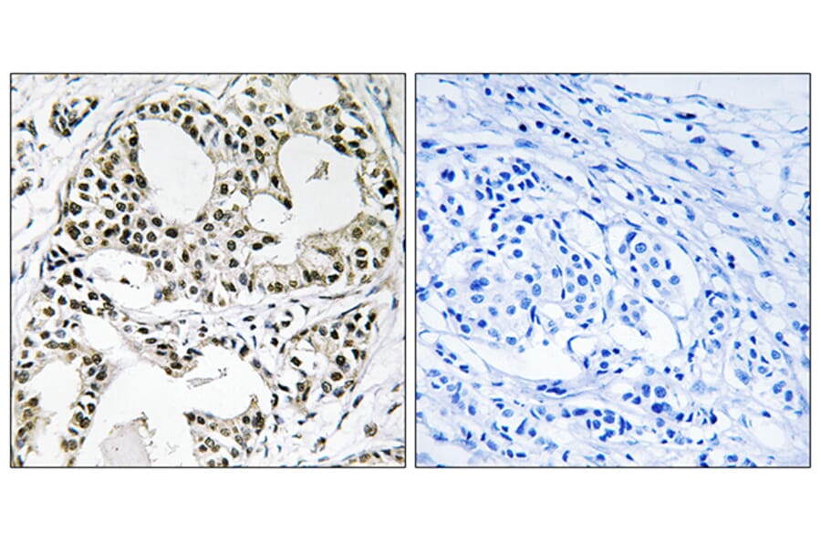 Immunohistochemistry - Anti-YEATS2 Antibody (C19565) - Antibodies.com