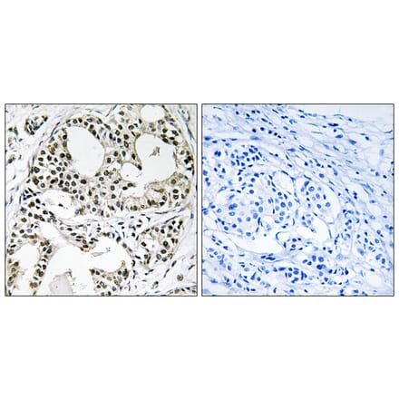 Immunohistochemistry - Anti-YEATS2 Antibody (C19565) - Antibodies.com