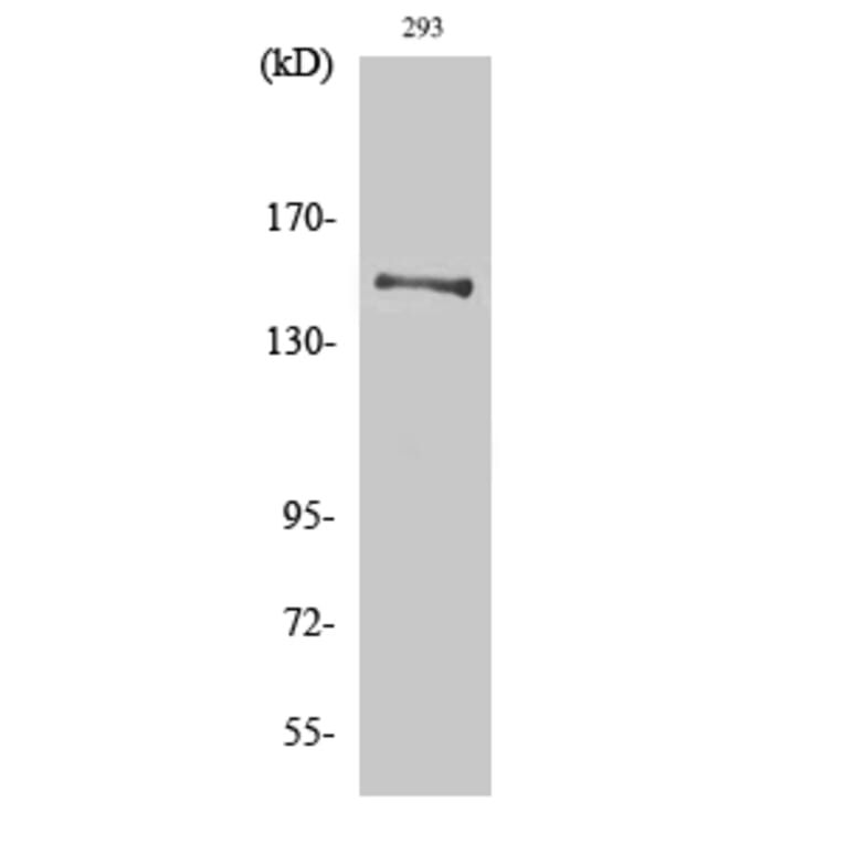 Western Blot - Anti-YEATS2 Antibody (C19565) - Antibodies.com