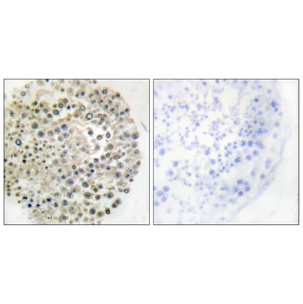 Immunohistochemistry - Anti-TRIM16 Antibody (C10224) - Antibodies.com