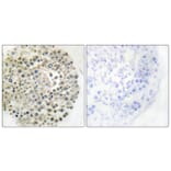 Immunohistochemistry - Anti-TRIM16 Antibody (C10224) - Antibodies.com