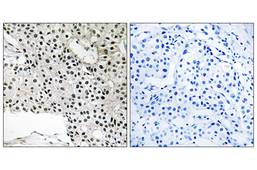 Immunohistochemistry - Anti-TCEAL4 Antibody (C19162) - Antibodies.com