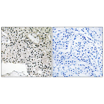Immunohistochemistry - Anti-TCEAL4 Antibody (C19162) - Antibodies.com