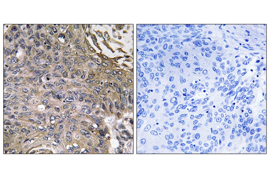 Immunohistochemistry - Anti-SH2D1B Antibody (C18698) - Antibodies.com