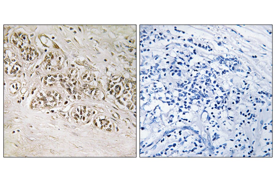 Immunohistochemistry - Anti-RAD54B Antibody (C19669) - Antibodies.com