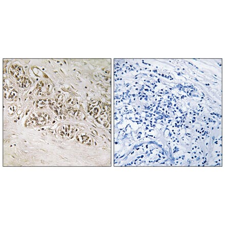 Immunohistochemistry - Anti-RAD54B Antibody (C19669) - Antibodies.com