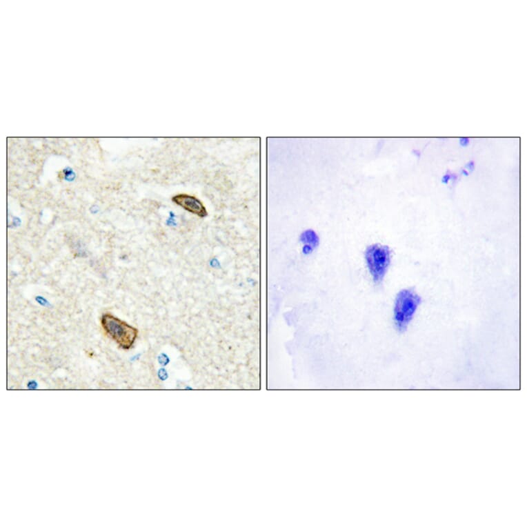 Immunohistochemistry - Anti-PLXDC1 Antibody (C11299) - Antibodies.com