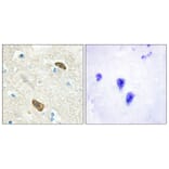 Immunohistochemistry - Anti-PLXDC1 Antibody (C11299) - Antibodies.com