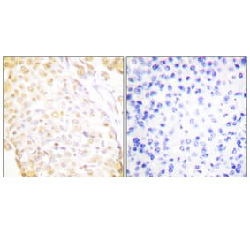 Immunohistochemistry - Anti-NKX3.1 Antibody (C0277) - Antibodies.com