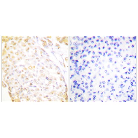 Immunohistochemistry - Anti-NKX3.1 Antibody (C0277) - Antibodies.com