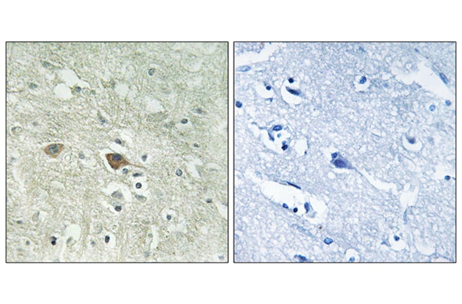 Immunohistochemistry - Anti-NDUFV3 Antibody (C16843) - Antibodies.com