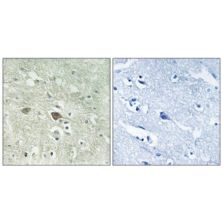 Immunohistochemistry - Anti-NDUFV3 Antibody (C16843) - Antibodies.com