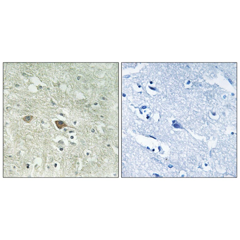 Immunohistochemistry - Anti-NDUFV3 Antibody (C16843) - Antibodies.com