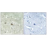 Immunohistochemistry - Anti-NDUFV3 Antibody (C16843) - Antibodies.com
