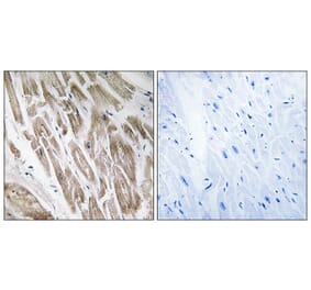 Immunohistochemistry - Anti-NDUFS5 Antibody (C16847) - Antibodies.com